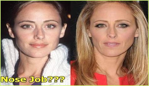 Kim Raver Plastic Surgery Before and After
